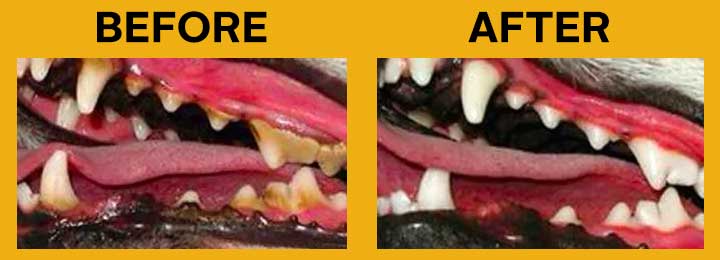 Dental Before After Image